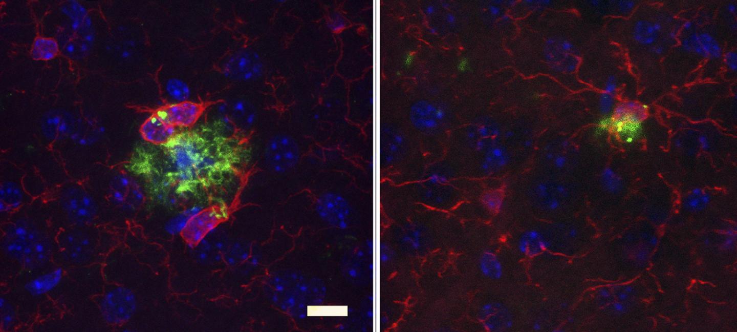 Antibiotics Reduce Alzheimer's Symptoms in Male Mice