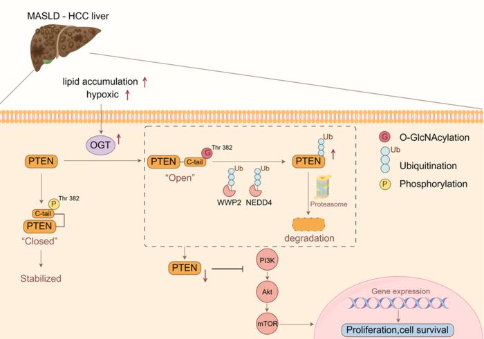 OGT Promotes MASLD-Related Liver Cancer by Driving PTEN Degradation