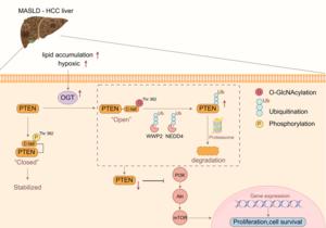 OGT Promotes MASLD-Related Liver Cancer by Driving PTEN Degradation