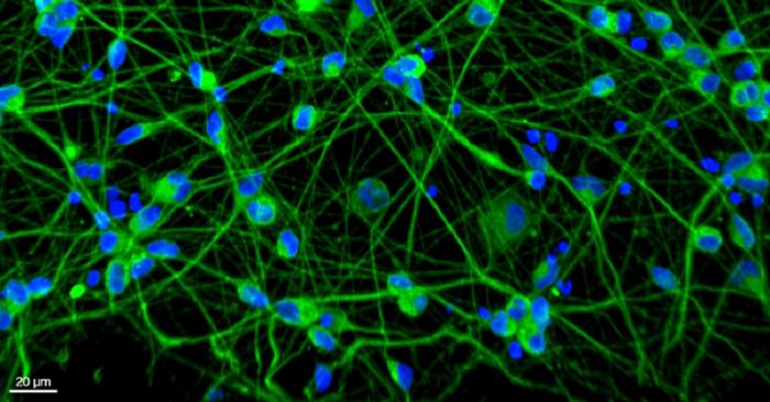 Human neurons