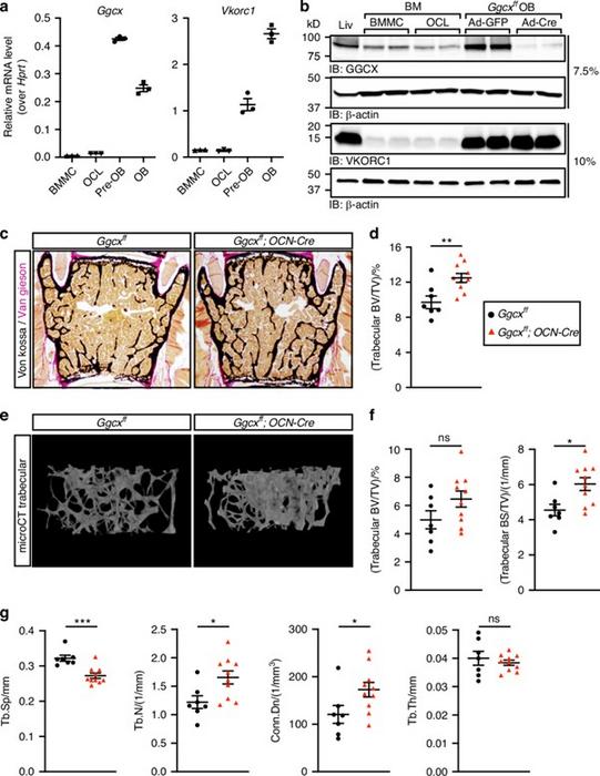 Vitamin K-Dependent GAS6 Signaling Regulates Bone Resorption in Male Mice
