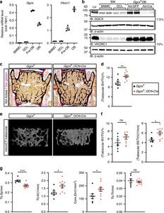 Vitamin K-Dependent GAS6 Signaling Regulates Bone Resorption in Male Mice
