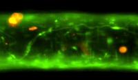 Tumor Cells Attach to Blood Vessel Wall