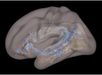 Child Brain Image