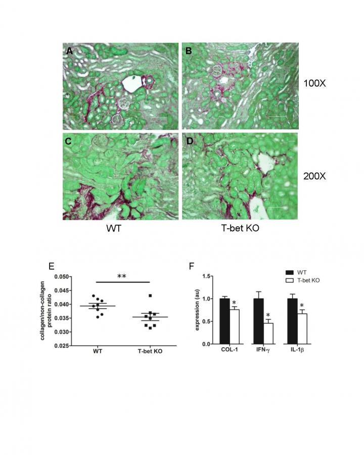 Scientists Report New Approach to Reduce or Prevent Renal Fibrosis