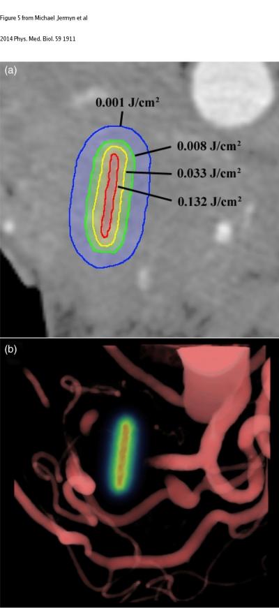 Single Axial Slice of the Pancreas