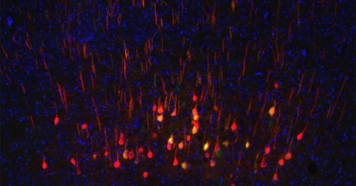 Neurons