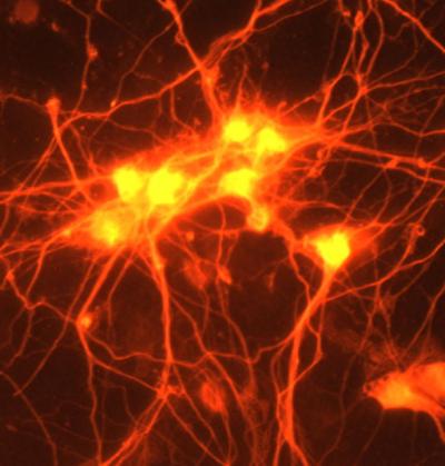 Sprouting Connections in the Brain