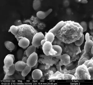 Eosinophils attacking C. albicans