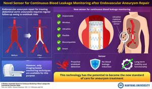 A Novel Sensor for Endoleak Detection