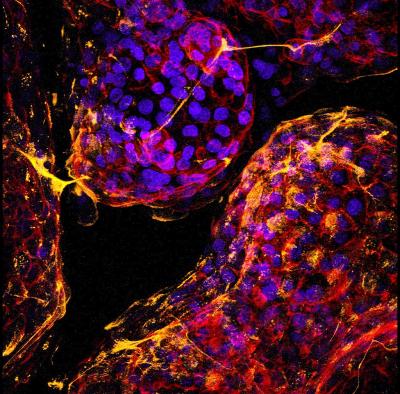 Growing Cells in 3-D