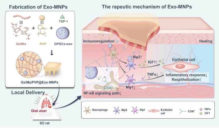 Schematic illustration of exosome-loaded microneedle patches for oral ulcer treatment.