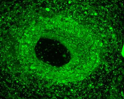 Cell Proliferation in Hard Environments (1 of 3)