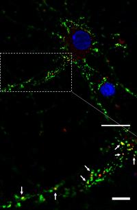 Alpha-Synuclein and PrPC Interacting in a Neuron