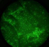 Healthy and Cancerous Cell Nuclei