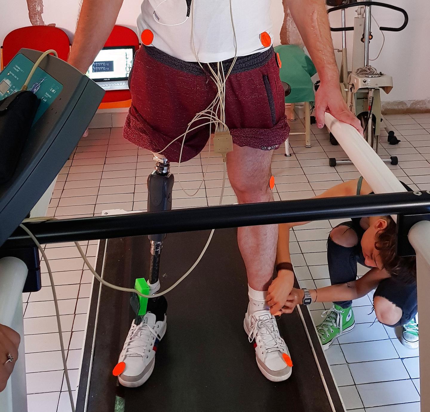 Nerve-Stimulating Leg Prosthesis Improves Movement and Functionality in Amputees (5 of 10)