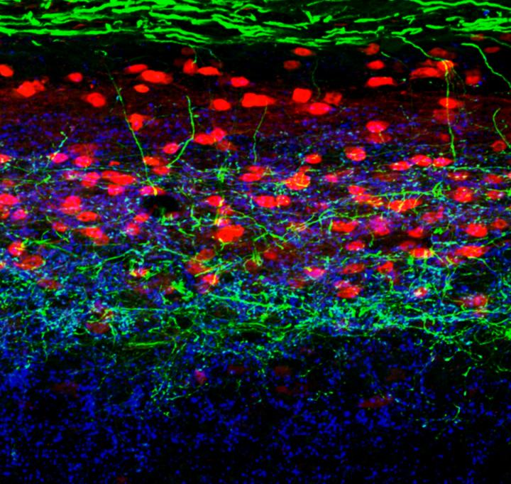 Cross-Section of a Mouse Dorsal Spinal Cord