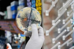 Candida culture