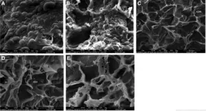 Scanning electron microscopy images of uterine pinopodes.