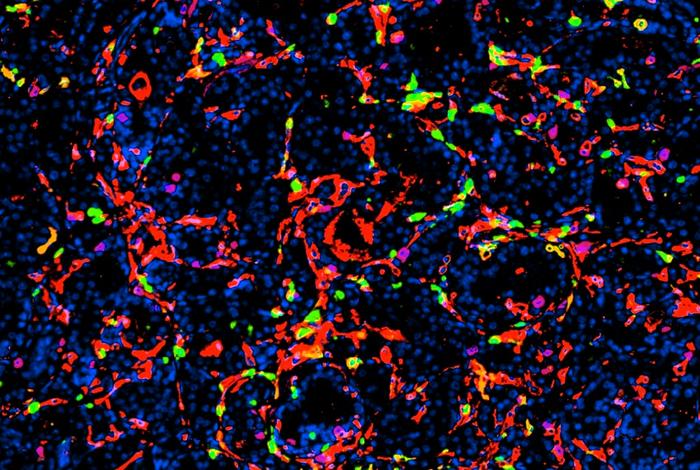 Experimental Treatment Directly Kills Prostate Tumor Cells While Reawakening Antitumor Immunity