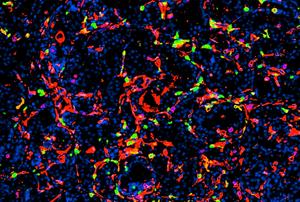 Experimental Treatment Directly Kills Prostate Tumor Cells While Reawakening Antitumor Immunity