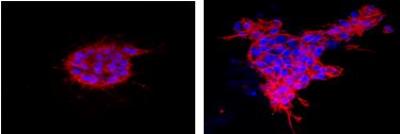 Human Breast Cell Lacking HOXA5