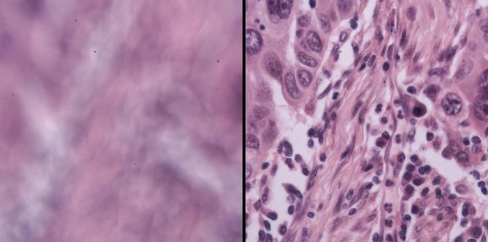 Simple New System Keeps Microscopes in Focus Automatically