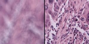 Simple New System Keeps Microscopes in Focus Automatically