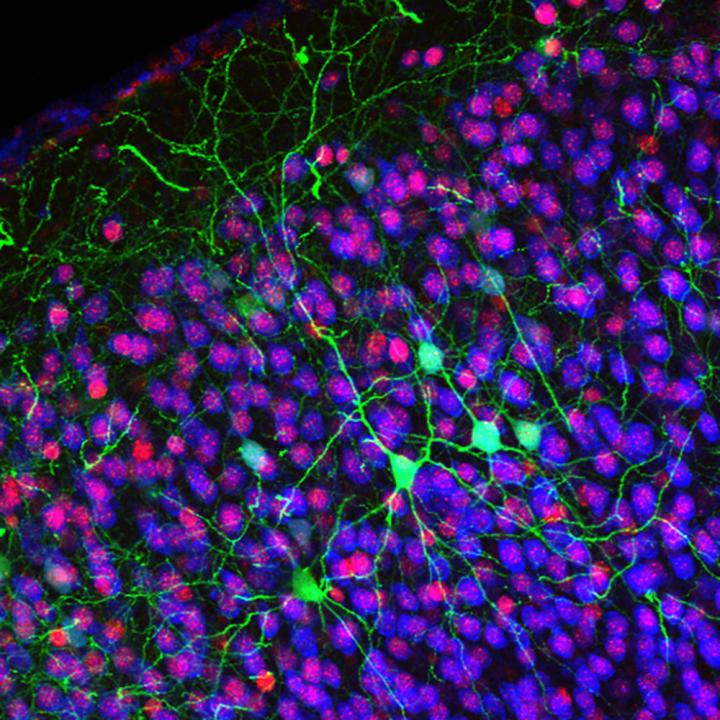 Callosal Projection Neurons