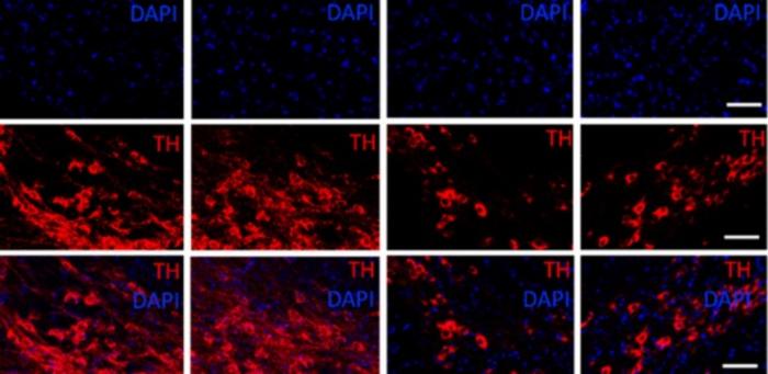 Anti-inflammatory molecule shows potential against Parkinson’s in study with mice