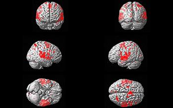 Functional MRI