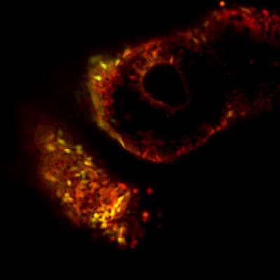 Hanna-iPS Derived Cells