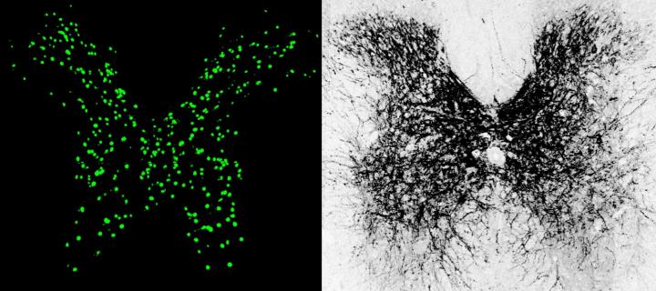 Boosting KCC2 Expression