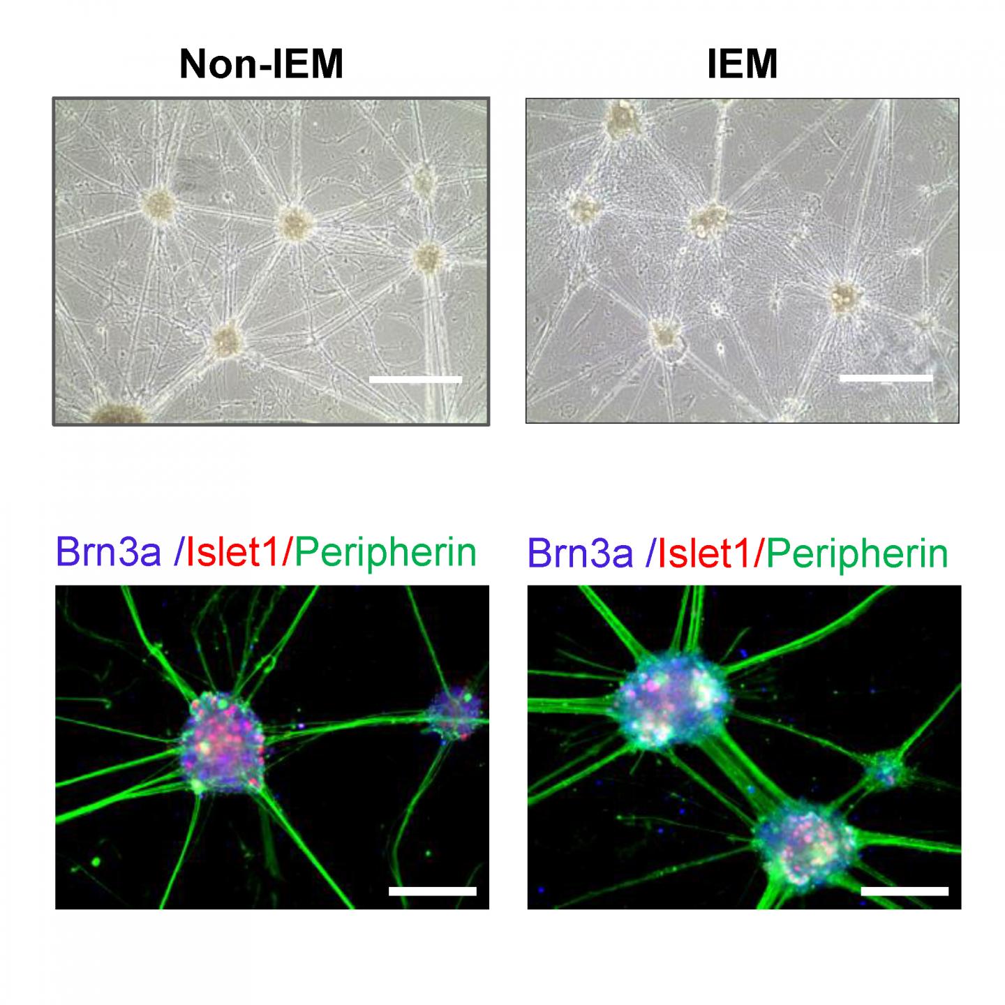 Stem Cells May Help Pinpoint Patient-Specific Painkiller