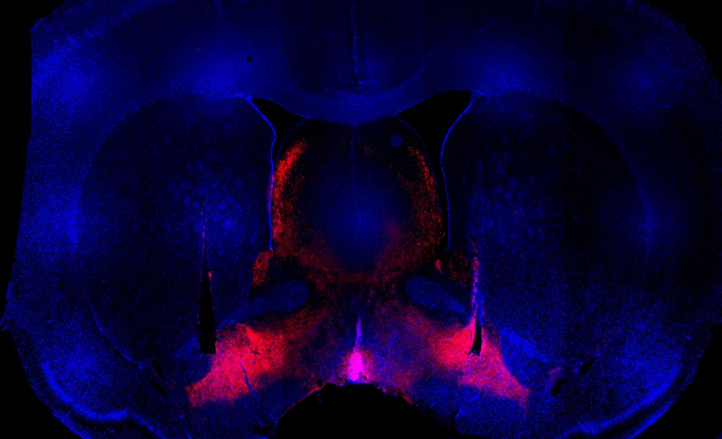Ventral Pallidum