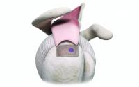 Rotator cuff implant
