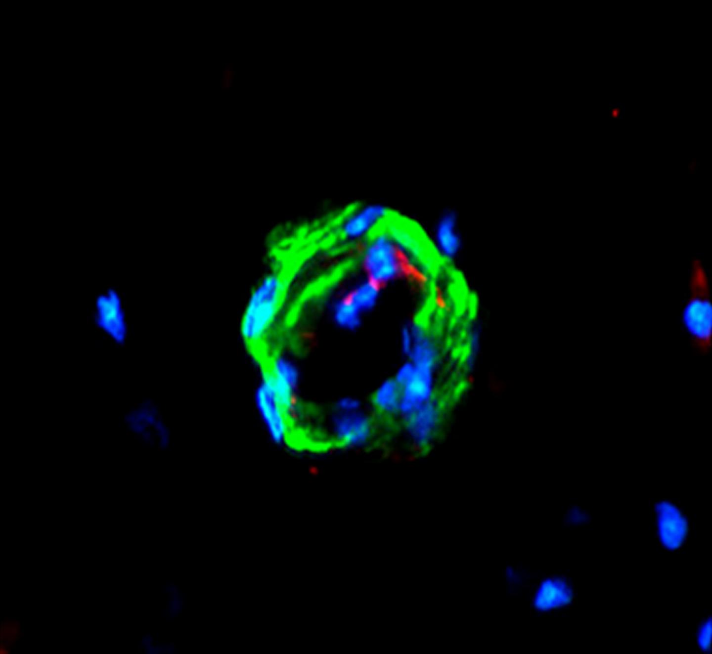 Uncovering a Way for Amyloid to Exit the Brain (5 of 6)