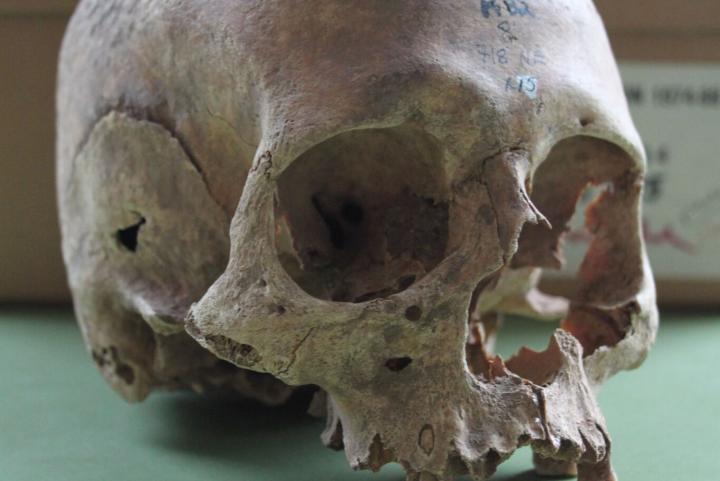 Female Skull