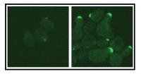 Comparison of Cell Signaling Braking Activity