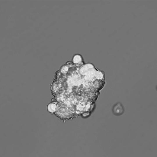 Mammospheres