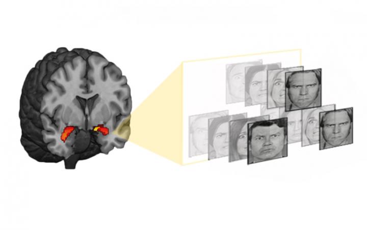 Amygdala