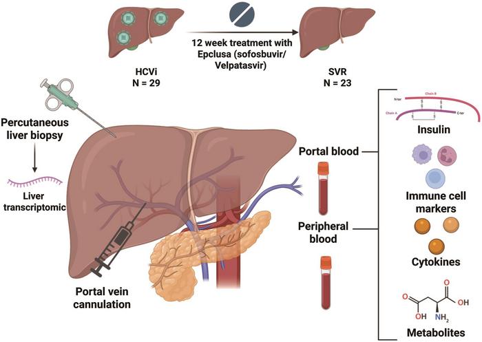 Association of Changes in Portal Insulin with Immunometabolism During and After Hepatitis C Virus Infection