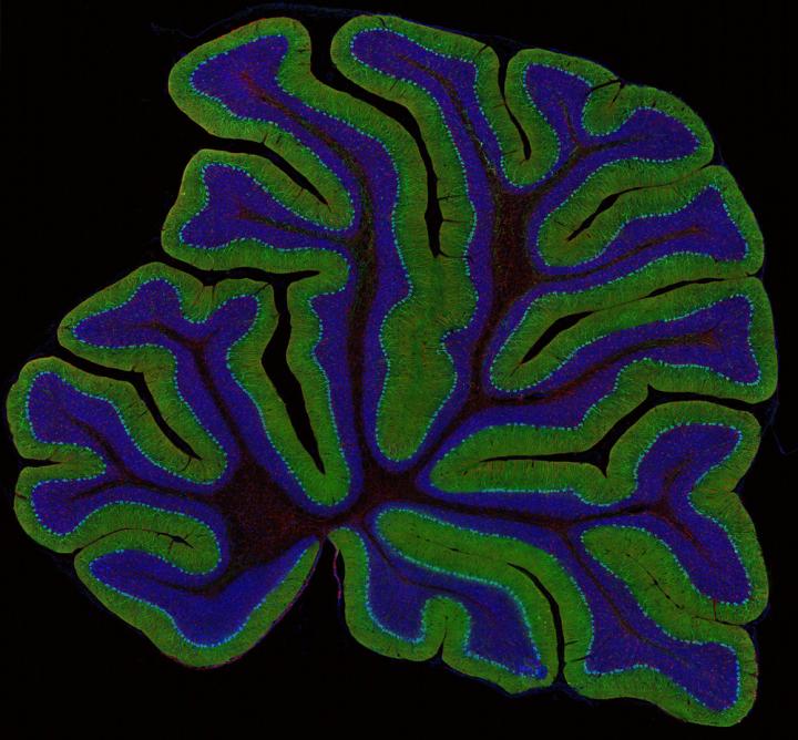Brain