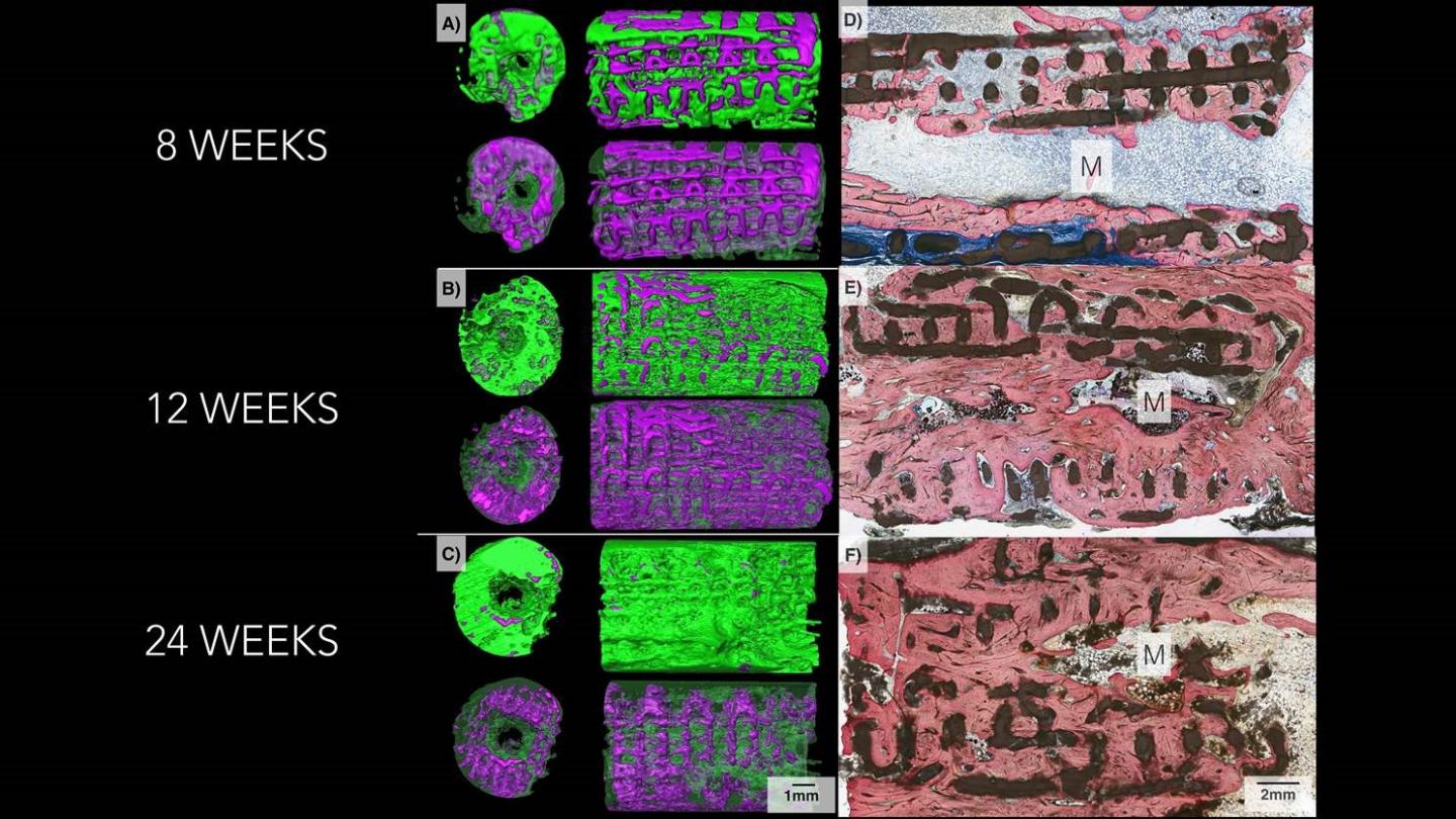 NYU Langone Health 3D and Microscope Bone Images