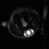 Video of Tarantula's Heart Beating