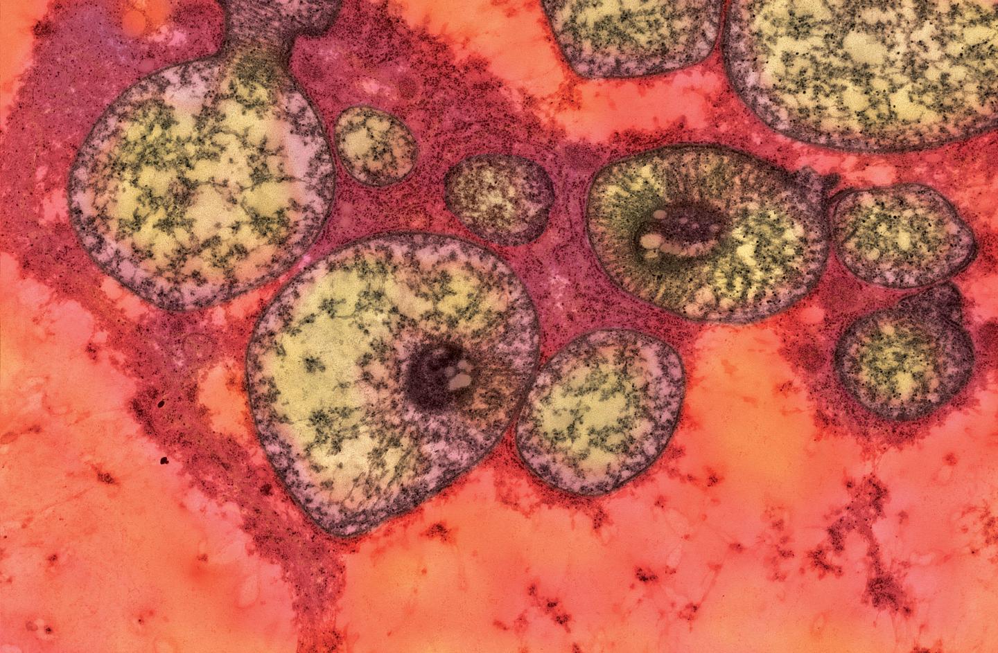 Methylmalonic Acidemia in Mouse