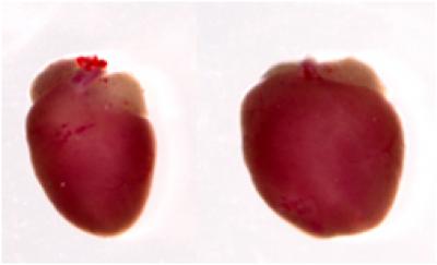 UNC Researchers Identify a Gene Critical for Heart Function