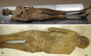 External appearance of the mummy