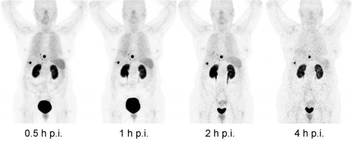 Biodistribution of 188 MBq 68Ga-OPS202 (15 μg) at 0.5, 1, 2, and 4 h Post Injection in Patient 2