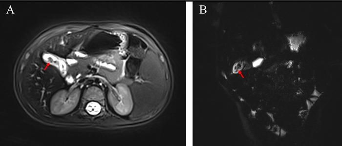 Fig1